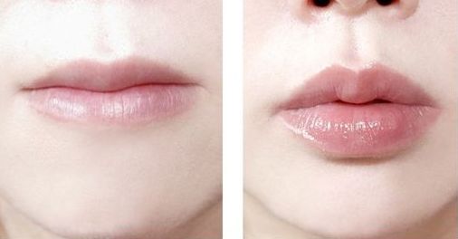 南京哪家醫(yī)院治療黃褐斑效果好？