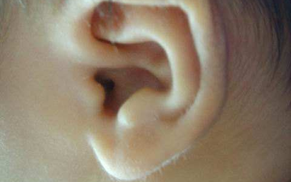 杭州華山程琳整鼻術(shù)態(tài)度與效果亮眼，醫(yī)師傳世之匠藝悅目案例展示