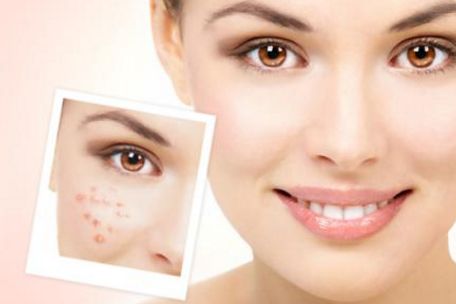 蘇州治療痘痘最好的醫(yī)院有哪些？