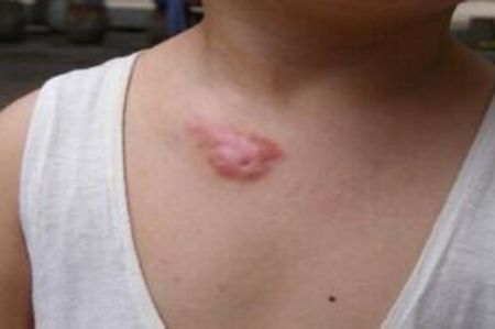 上海切眼袋手術(shù)醫(yī)院排名及口碑如何？