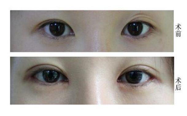 桂林有哪些去痘療效好的醫(yī)院值得推薦？