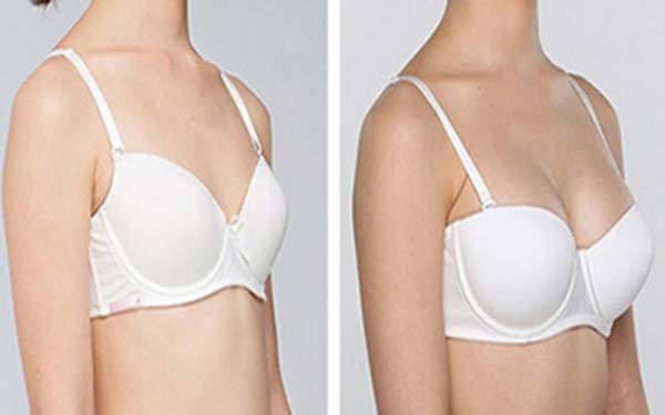 2023黑龍江3D精微祛眼袋在榜名單前10位專(zhuān)家(魯文起、尹又階、李麗麗個(gè)個(gè)醫(yī)生人氣高)