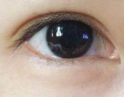 蘇州哪家祛痘醫(yī)院好？專家推薦的治療痘痘效果好的醫(yī)院