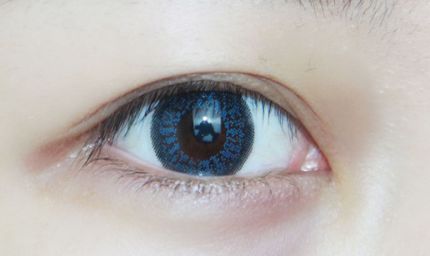 淮南市醫(yī)院有做雙眼皮手術(shù)嗎？手術(shù)技術(shù)如何？?jī)r(jià)格如何？實(shí)例解析給您參考