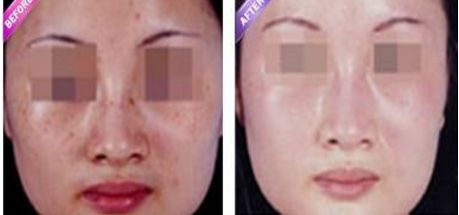 2024年重慶最受歡迎的吸脂醫(yī)院排名