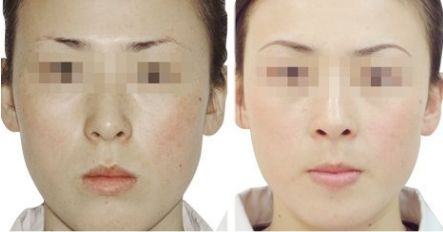 衡陽雅美開啟逆齡狂歡，網(wǎng)紅臉、幼態(tài)臉任你選