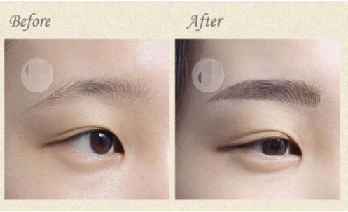 成都華西口腔種植牙費(fèi)用一覽表出爐！想了解非常受歡迎的五位醫(yī)生？