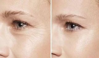 杭州雙眼皮手術(shù)：醫(yī)院排行榜及受歡迎的專業(yè)醫(yī)療資訊