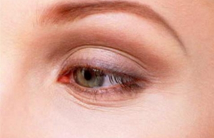 南京施爾美吸脂是有效的嗎？它是否能達(dá)到理想效果？