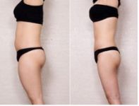 上海長征醫(yī)院引領(lǐng)植發(fā)領(lǐng)域，李宇飛頗受好評(píng)，專家名單曝光！