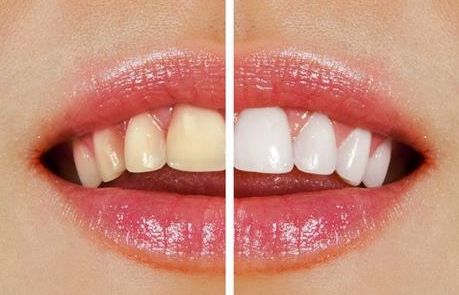 榆林市第一醫(yī)院最牛眼科專家曝光！秒懂近視眼手術(shù)真相