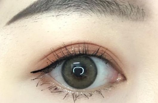 深圳保麗圣瑞整形醫(yī)院面部脂肪填充2023案例分享，效果好嗎？