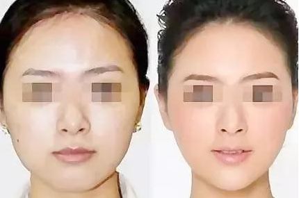 南京華美美容醫(yī)院：值得信賴的專業(yè)醫(yī)生、熱門項(xiàng)目和滿意口碑