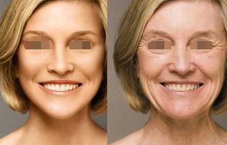 2024湖南正頜手術(shù)哪里做的好