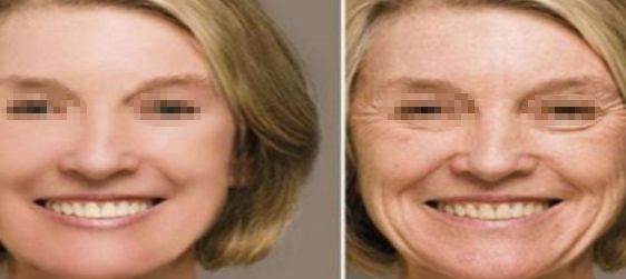 愛(ài)爾眼科：私人正規(guī)高水平眼科醫(yī)院