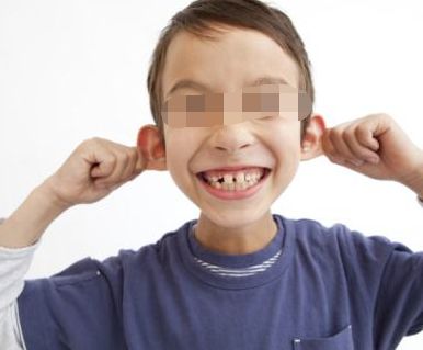 重慶隱形矯正哪家醫(yī)院技術(shù)先進(jìn)服務(wù)好