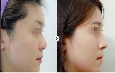 2024年度中國整容醫(yī)院匯總：最佳五家醫(yī)療機(jī)構(gòu)揭曉