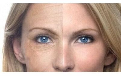 上海華美謝衛(wèi)國(guó)醫(yī)生：隆鼻案例驚艷，塑造完美鼻型效果太真實(shí)