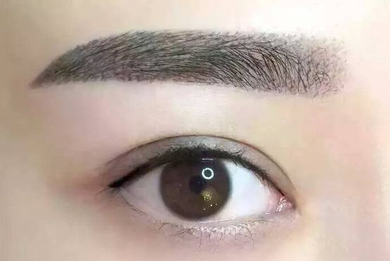 喬軍醫(yī)生眼部整形手術(shù)能力如何？詳解醫(yī)生經(jīng)歷與成功案例