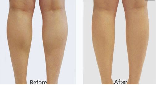 射頻緊膚整形醫(yī)院排行榜，專家推薦的三家一流醫(yī)院震撼上榜