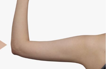 銀川陳勇博士醫(yī)療美容整形醫(yī)院醫(yī)生團(tuán)隊(duì)是否備受認(rèn)可？他們的案例能夠展現(xiàn)多少成功經(jīng)驗(yàn)？