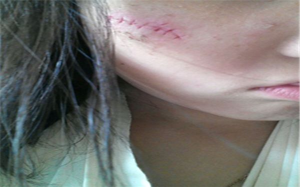 鄭州整形醫(yī)院排行前五！這五家醫(yī)院值得一看！