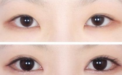 上海九院最佳雙眼皮整形專(zhuān)家排行榜揭曉