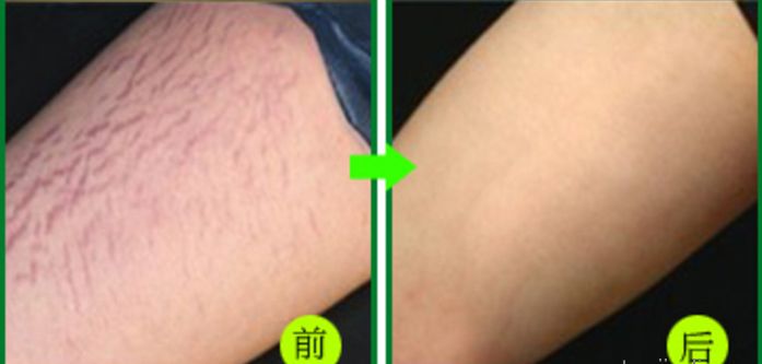 杭州整容醫(yī)院推薦，這幾家非常值得選擇