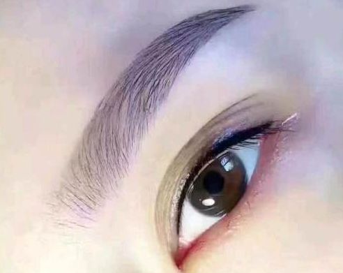 孟慶鵬最新鼻部整形手術(shù)效果怎么樣？贊譽(yù)無(wú)數(shù)的醫(yī)生評(píng)價(jià)+手術(shù)案例分享！鄭州uu們必看~