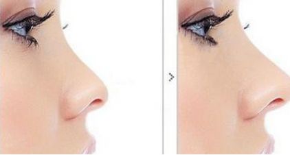 蘭州比較好的乳房整形醫(yī)院排名最新公布！附最新價(jià)格表，必收！