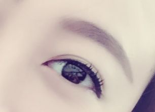 劉春軍豐胸手術后效果如何？費用怎么樣？醫(yī)生概況+隆胸真實案例圖為參考