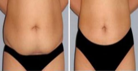 深圳2023年最有口碑的面部填充醫(yī)生推薦！快來看看他們的簡介！