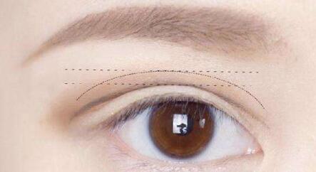 寧波113醫(yī)院美容祛斑靠譜嗎？哪家醫(yī)院好