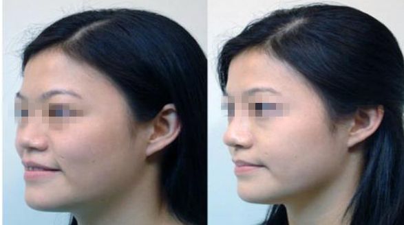 濟南市哪家整形醫(yī)院正規(guī)專業(yè)？推薦可靠的名單