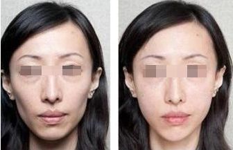 北京頂尖整形醫(yī)院排行榜公布，這三家實(shí)力過(guò)硬