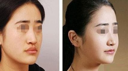 廣東哪家整形醫(yī)院口碑比較好