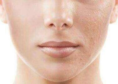 徐州三院整形美容科的蘇本玄主任值得信賴嗎？他有哪些專業(yè)優(yōu)勢(shì)？