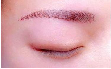 深圳醫(yī)生劉冰的鼻子整形效果如何？專業(yè)實(shí)力及成功案例發(fā)布