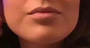 2023北京八大處醫(yī)院雙眼皮手術(shù)醫(yī)生榜單揭曉，楊明勇、王佳琦、靳小雷等醫(yī)師備受好評(píng)！