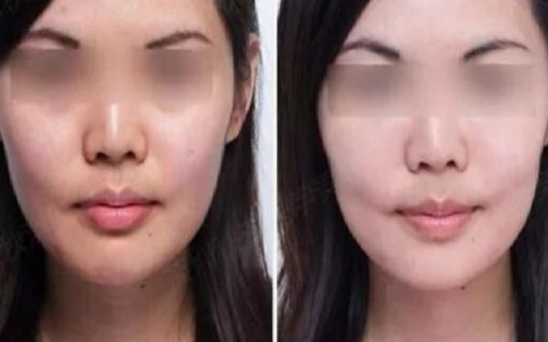 天津頂級整形醫(yī)院解析