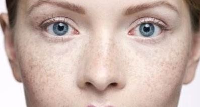 成都江濤醫(yī)生專業(yè)提供雙眼皮修復(fù)服務(wù)，助您重拾雙眼魅力