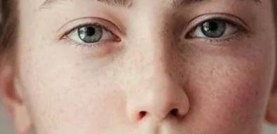 深圳鵬愛整形術(shù)后效果如何？胸部隆胸手術(shù)案例分享