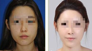 山東頂尖整形醫(yī)院排名大揭秘