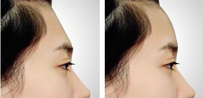 北京的八大處拉皮手術(shù)專家名單曝光！章慶國居首！