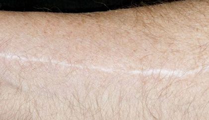 《青島王醫(yī)生的雙眼皮手術(shù)效果如何？專業(yè)簡介與真實案例分享》