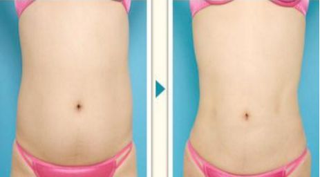 上海頂級疤痕治療醫(yī)院推薦，排名前三，性價比超高！