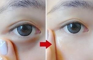 南通人民醫(yī)院眼科專家團(tuán)隊露面！這5位備受好評的專家赫然名列其中