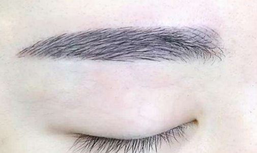 北京市優(yōu)質(zhì)微整形醫(yī)院推薦，絕對讓你滿意！