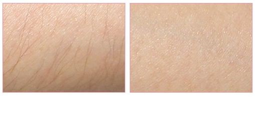 沈陽(yáng)沈河盛京尚美醫(yī)療美容門診部值得信任嗎？當(dāng)?shù)鼐用駥?duì)其口碑如何評(píng)價(jià)？