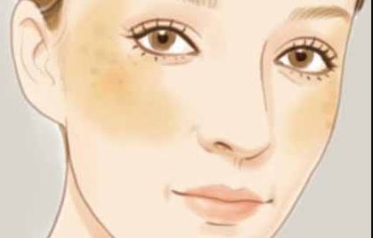 嘗試挑戰(zhàn)的你是否好奇劉珍君雙眼皮質(zhì)量如何？